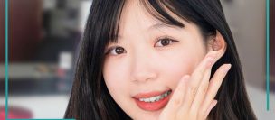 Khách hàng niềng răng tại Nha khoa Opal